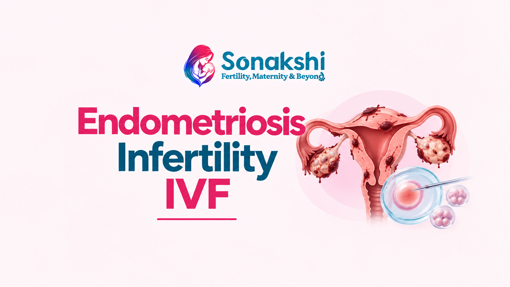 Endometriosis Infertility IVF: What Every Woman Trying to Conceive Should Actually Know
