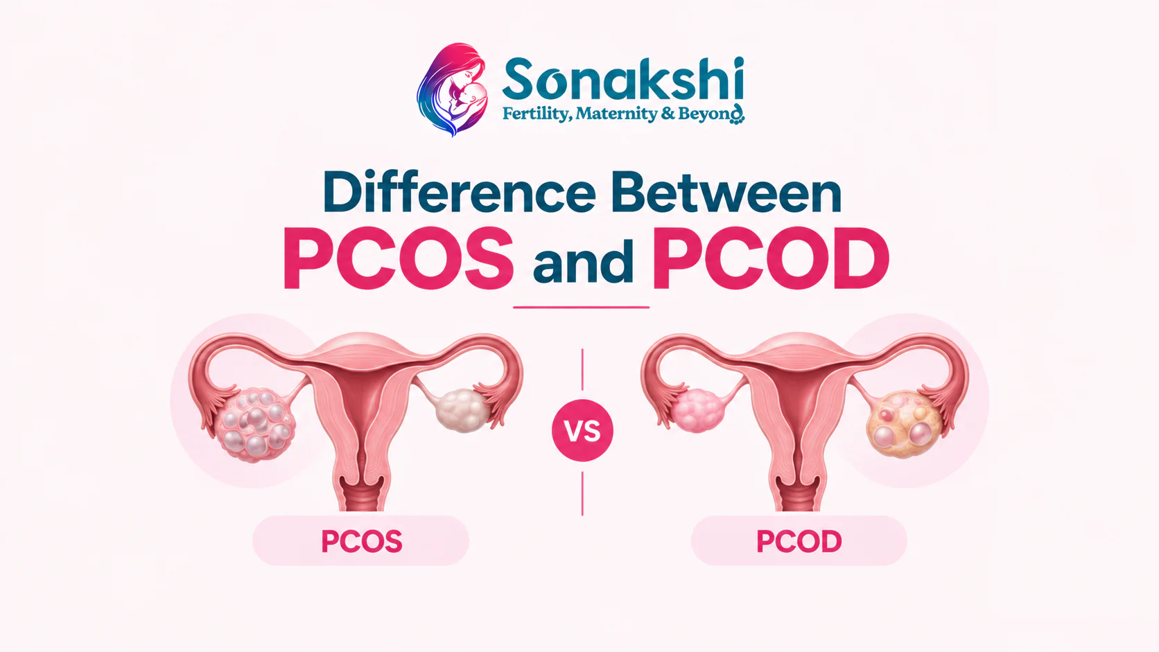 Difference Between PCOS and PCOD? Symptoms, Causes and Key Differences